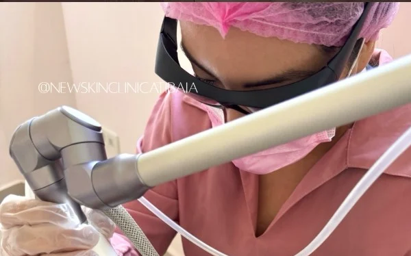 Profissional da New Skin, de touca, máscara e óculos de proteção, conduzindo a ponteira do laser durante uma sessão.